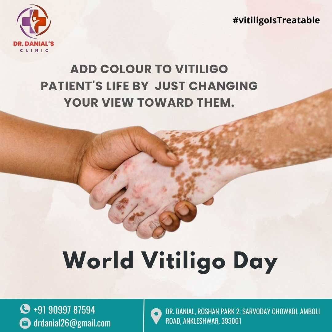 World Vitiligo Day, international days graphics